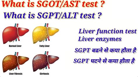 sgot sgpt meaning in tamil|Can SGOT/SGPT level demonstrate the extent of liver damage.